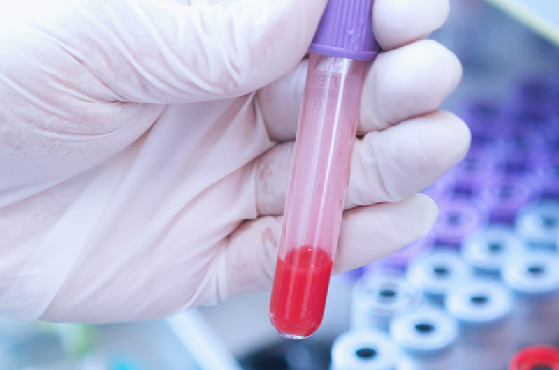 血液検査（血中ホルモン検査）